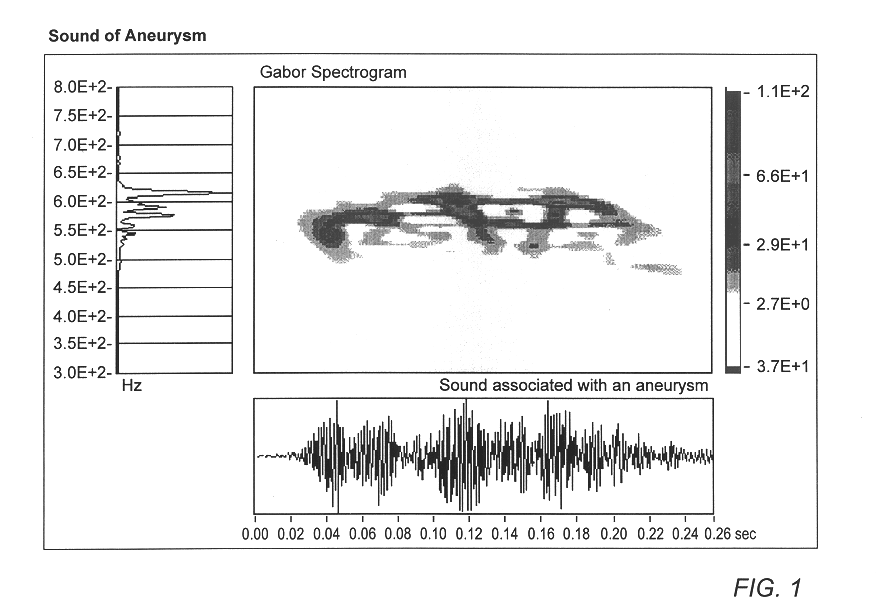 Signal analyzer system and method for computing a fast Gabor spectrogram