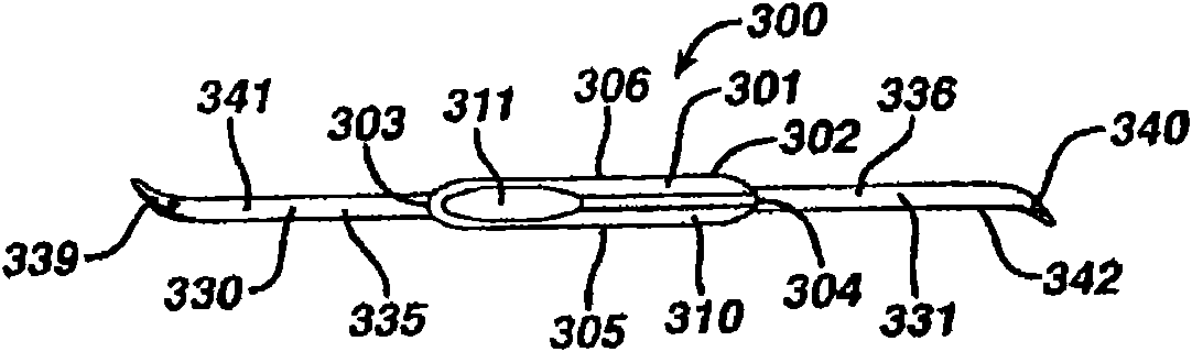 Implants and methods for pelvic floor repair