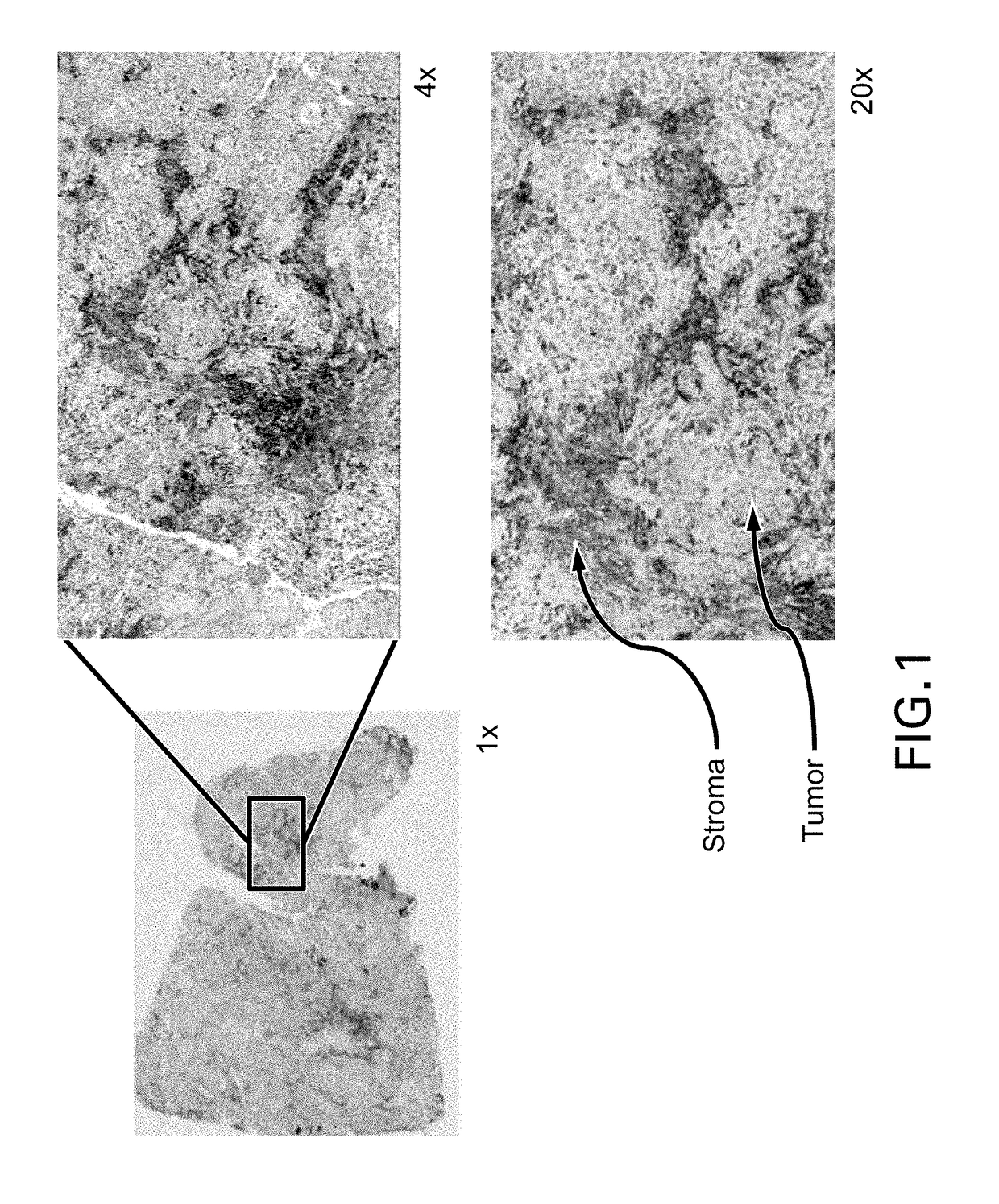 Immunohistochemical assay for detecting expression of programmed death ligand 1 (pd-l1) in tumor tissue