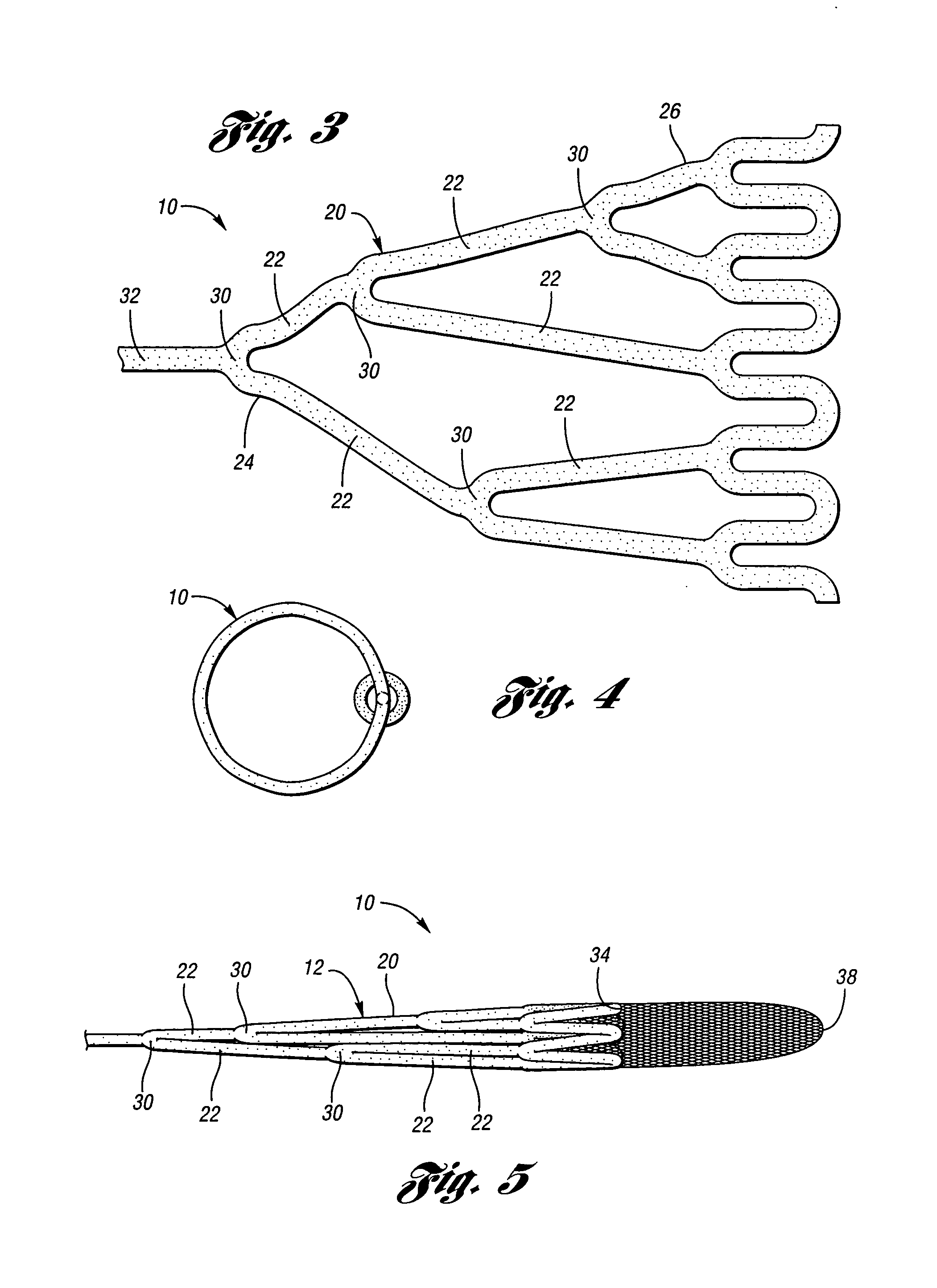 Embolic protection device having a reticulated body with staggered struts