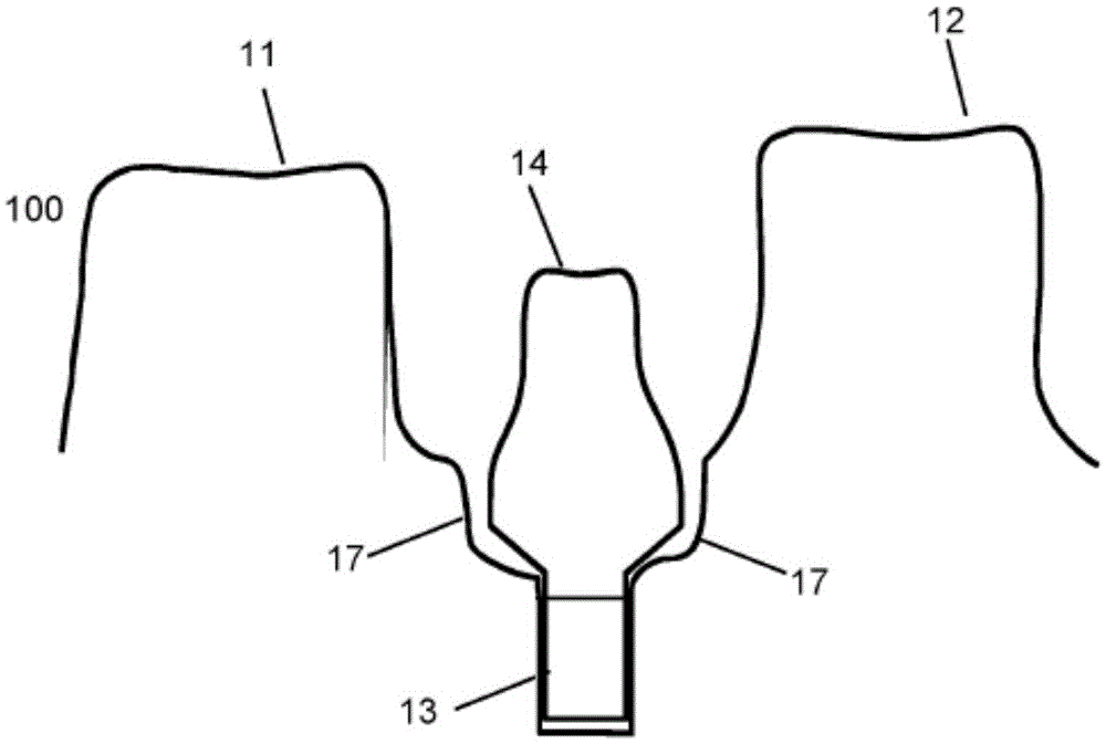 Method for modifying the gingival portion of a virtual model of a set of teeth