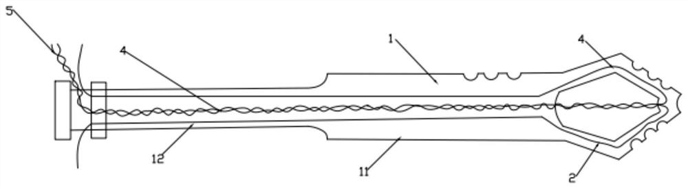 Percutaneous intrahepatic bile duct-ascites shunt synchronous drainage tube