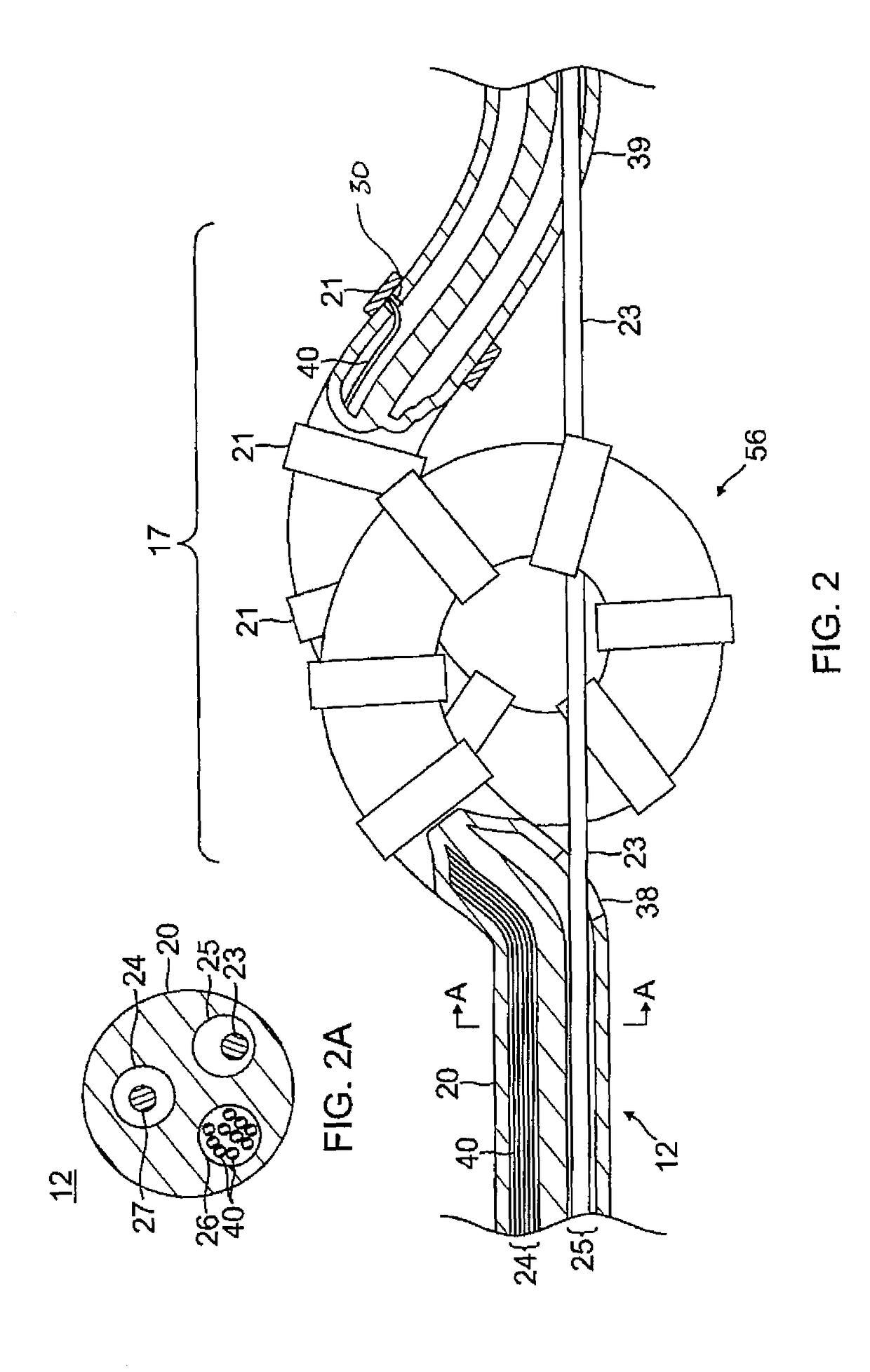 Catheter adapted for use with guide wire for accessing vessels