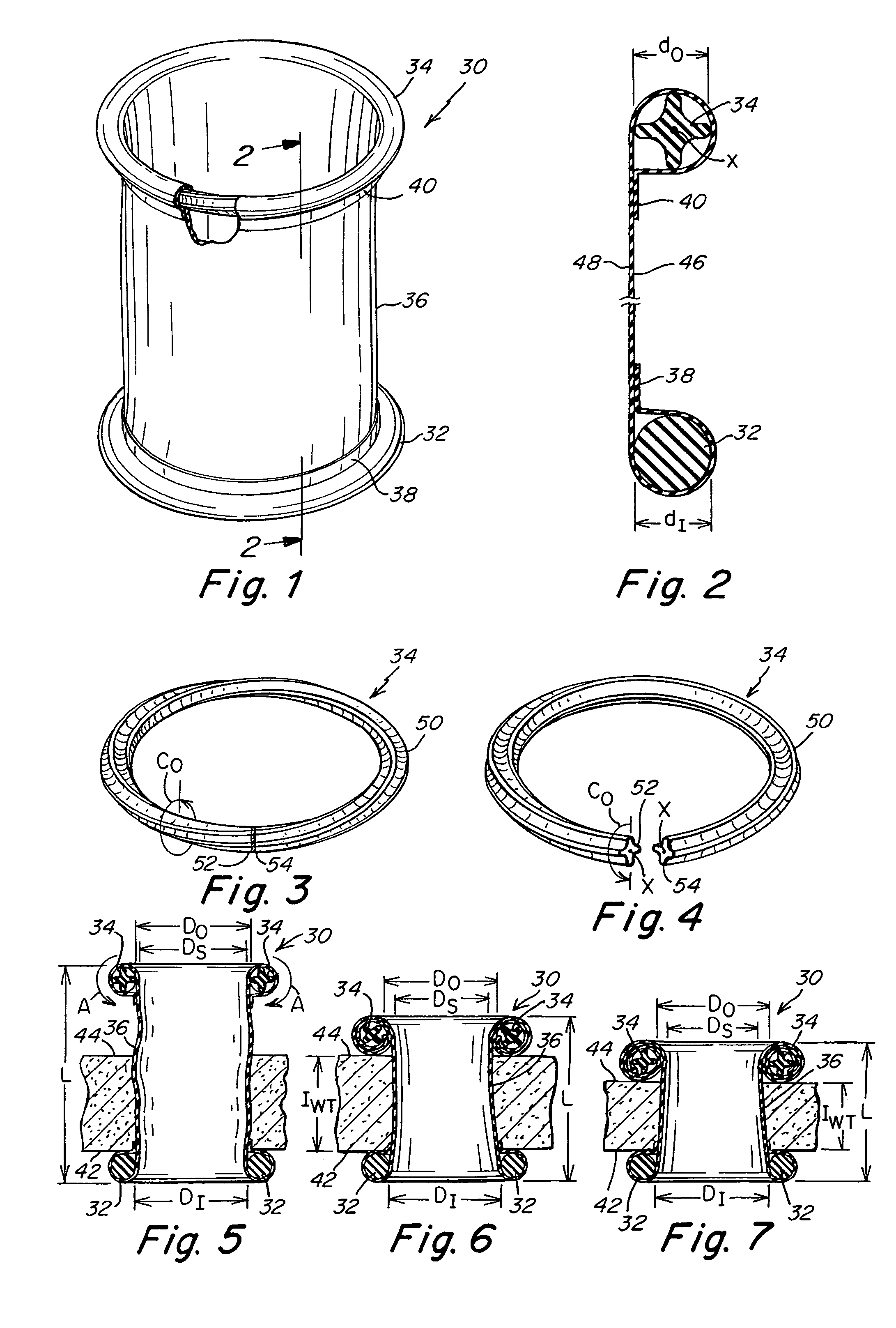 Abdominal retractor