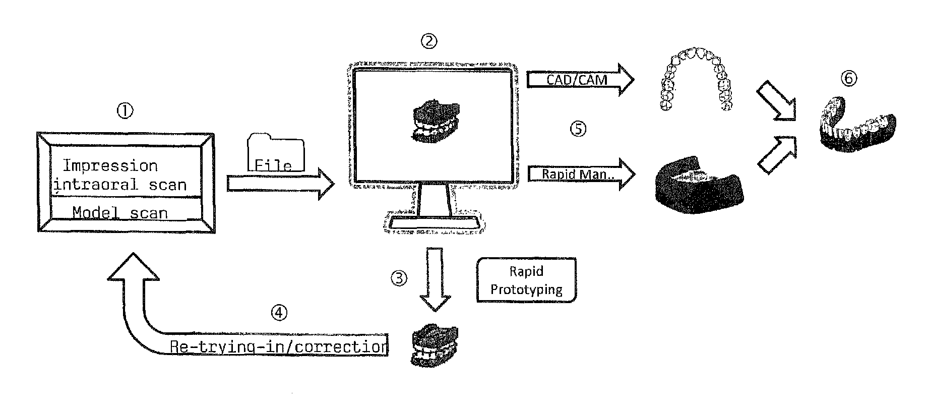 Production of individual dental prostheses via CAD/CAM and rapid manufacturing/rapid prototyping from data of the digital impression