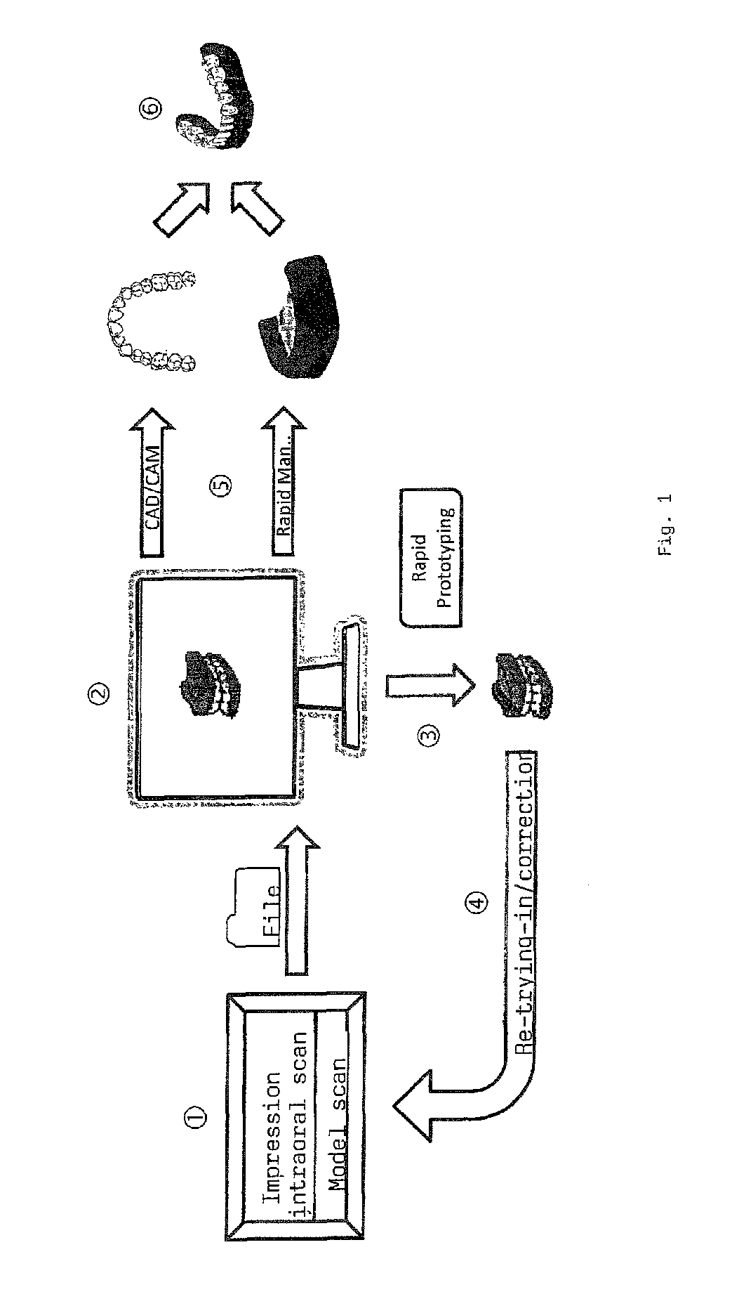 Production of individual dental prostheses via CAD/CAM and rapid manufacturing/rapid prototyping from data of the digital impression