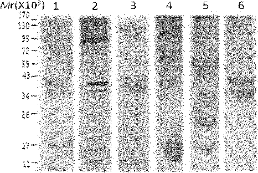 Aspergillus immunodominance antigen and application thereof