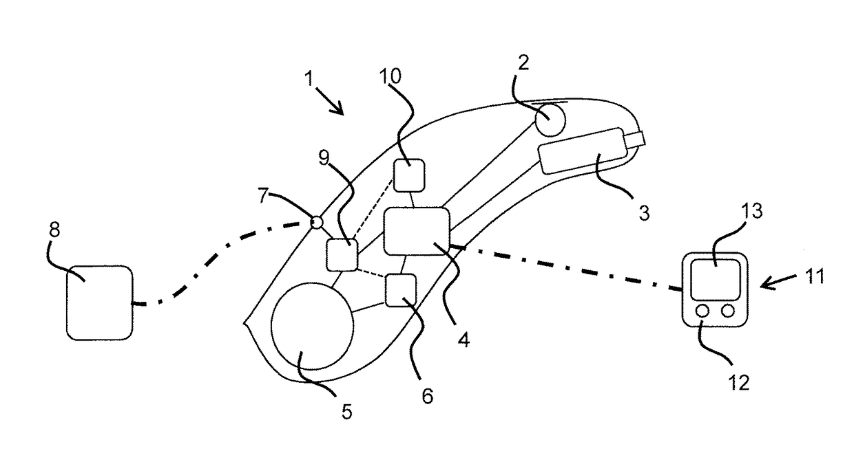 Method for Charging a Battery of a Hearing aid and a Hearing Aid with a Battery Charging Unit