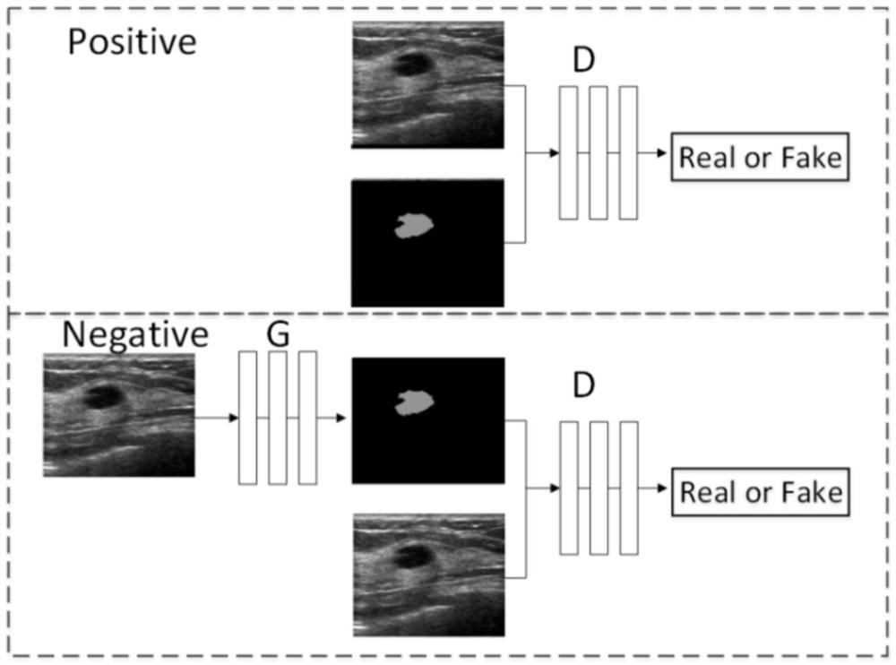 A method for predicting the aggressiveness of thyroid nodules based on deep learning segmentation network