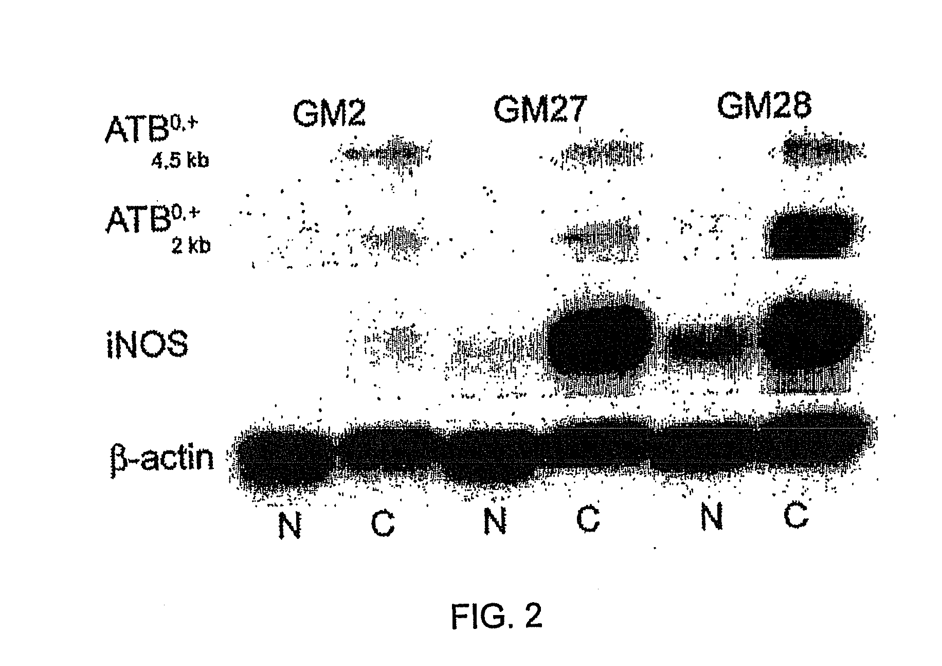 Prodrugs of short-chain fatty acids and treatment methods