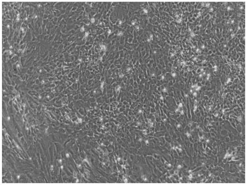 Mixed stem cell injection containing three vascular regeneration attributes and preparation method thereof