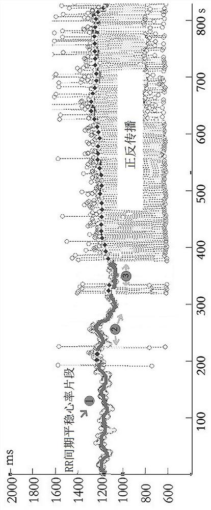 Method of Obtaining Dominant Heart Rate of Heartbeat Based on Forward and Back Propagation Algorithm