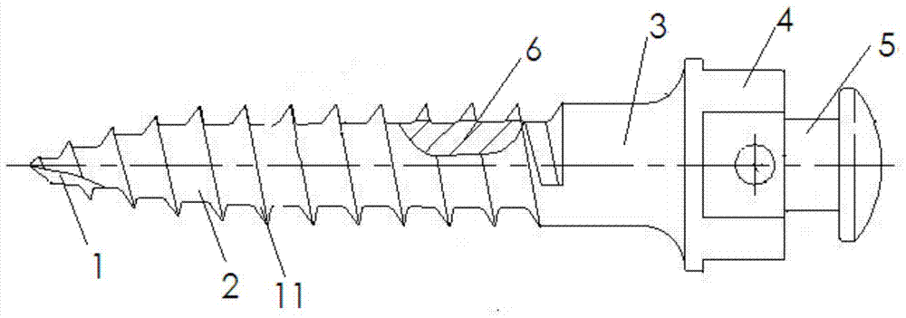 A kind of micro-anchor nail and correction device containing the micro-anchor nail