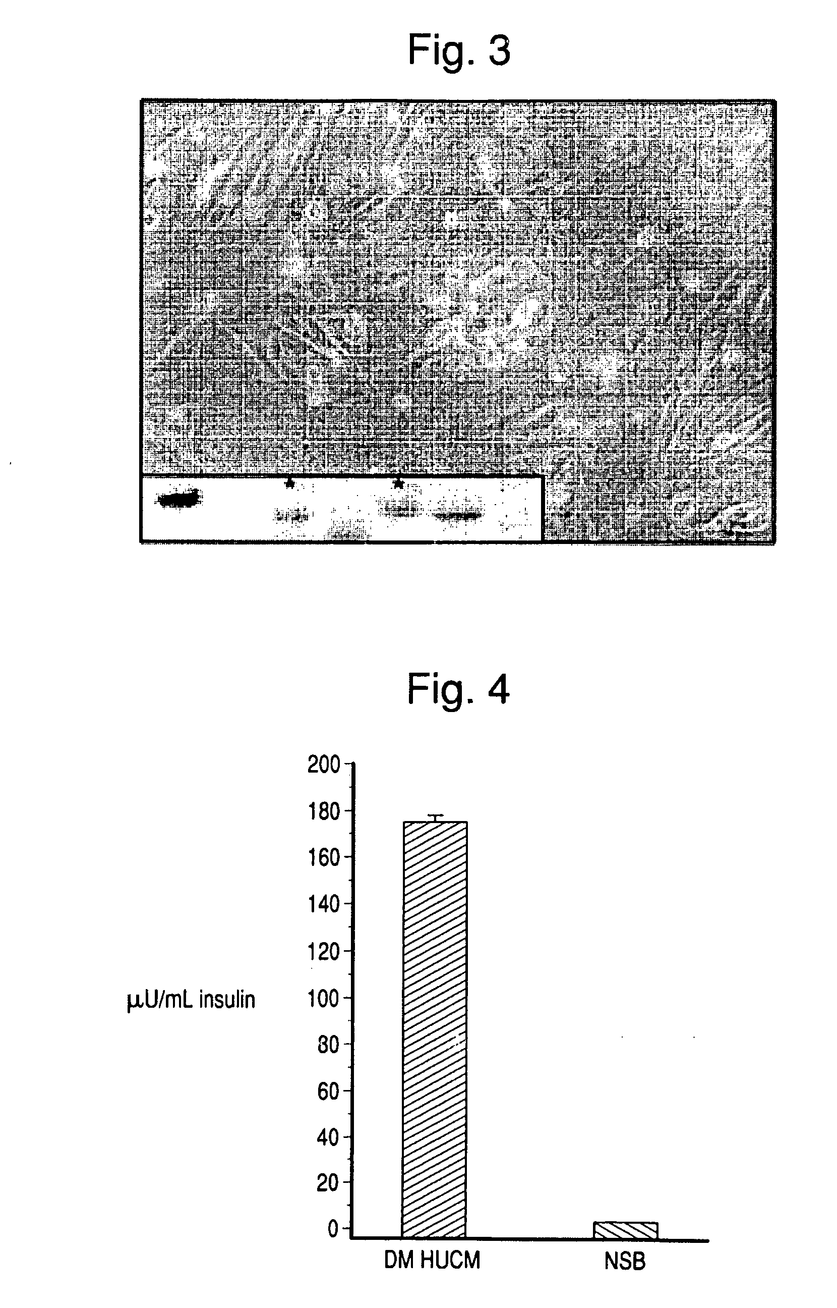 Method of differentiating mammalian progenitor cells into insulin producing pancreatic islet cells