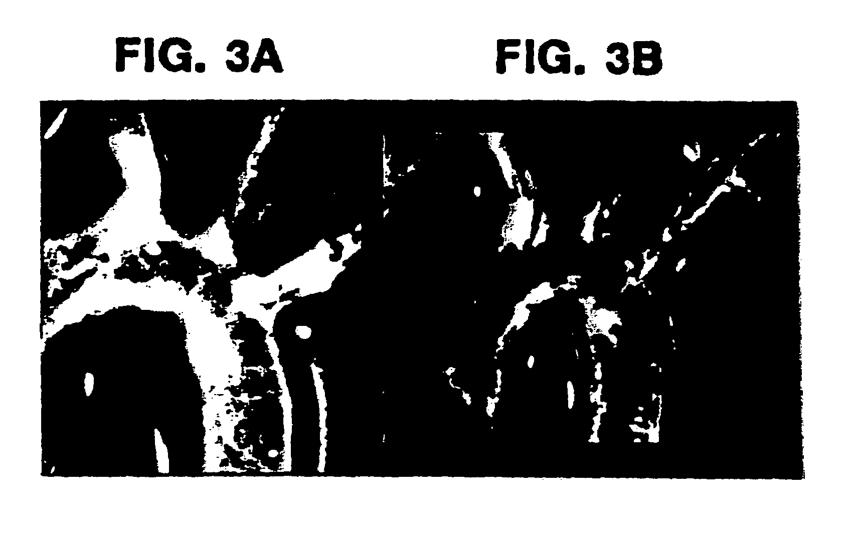 Method for inhibiting accelerated atherosclerosis in a subject suffering from hypercholesterolemia or hypertriglyceridemia