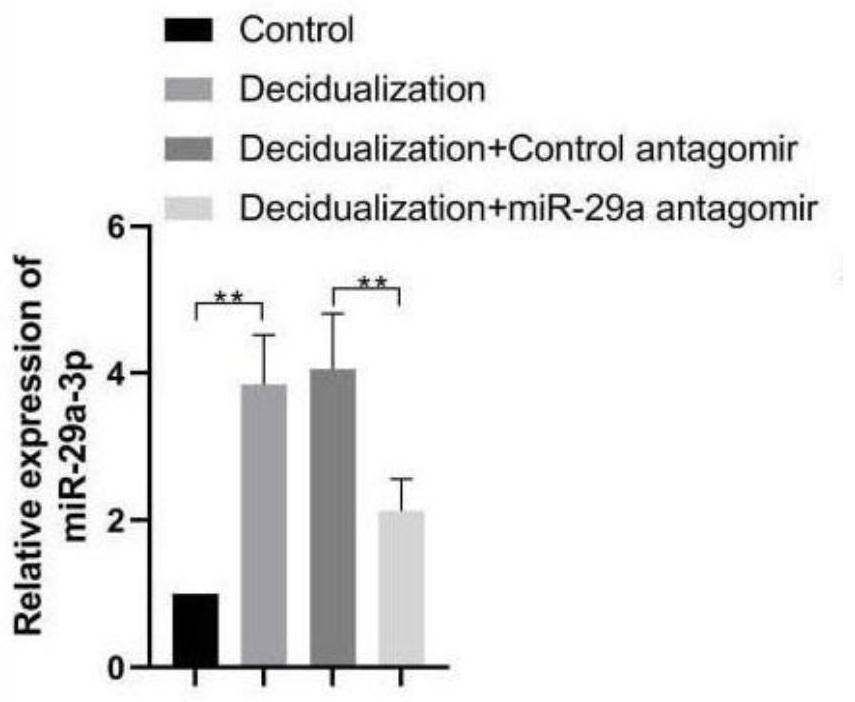 MiRNA marker for diagnosing early abortion and application thereof