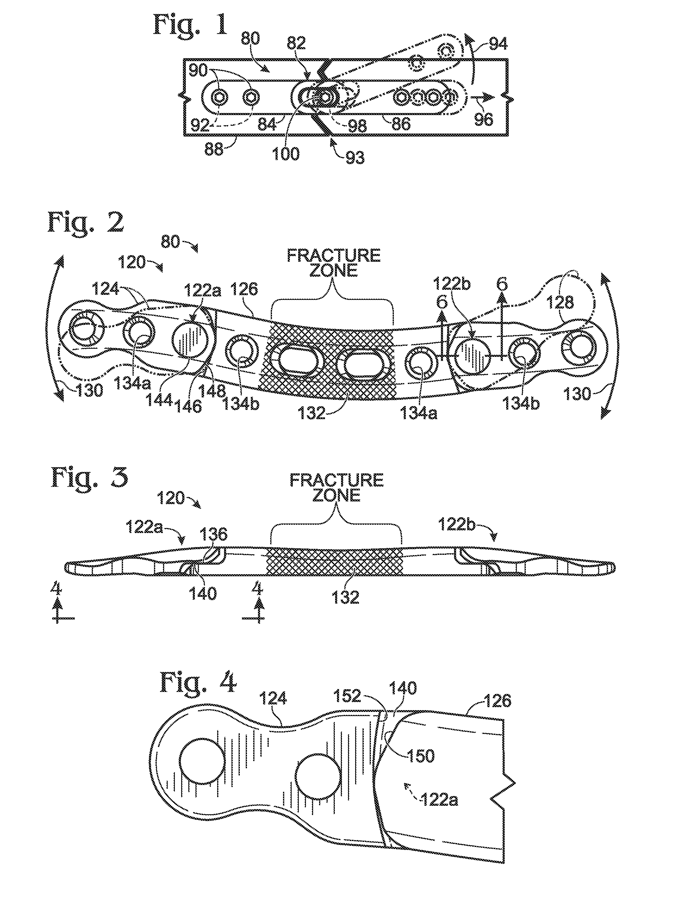 Bone plate with movable joint