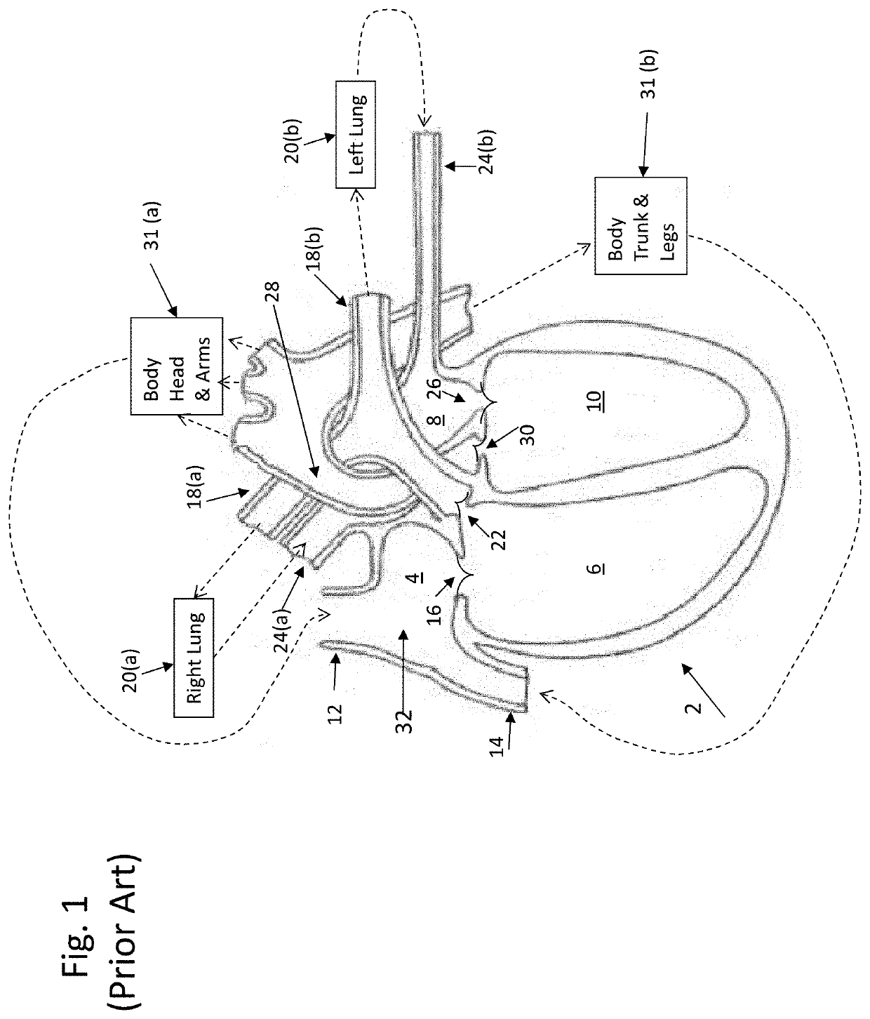 Monitoring cardiac blood flow balance relationship between the right and left heart chambers and cardiac regulation