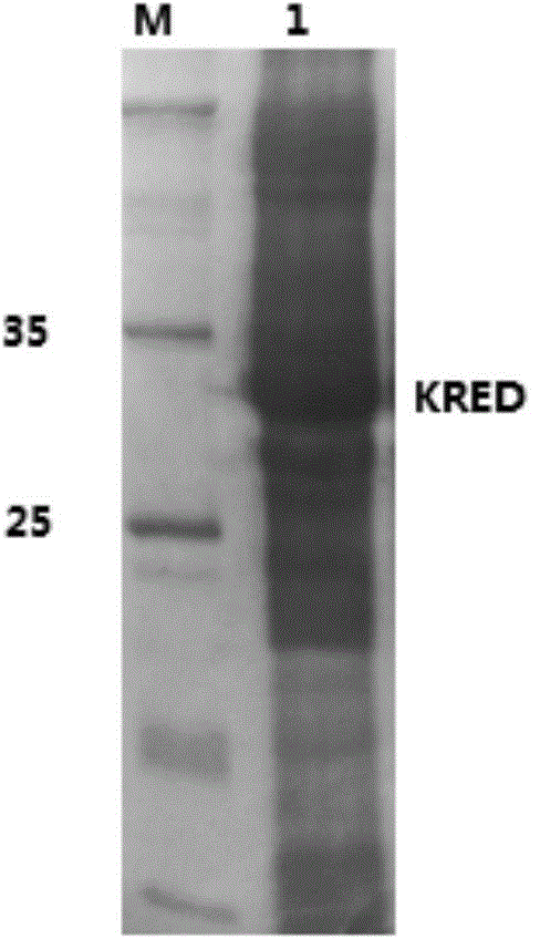 Aldo-keto reductase and application thereof in synthesis of (2S,3R)-2-benzoylaminomethyl-3-hydroxybutyrate