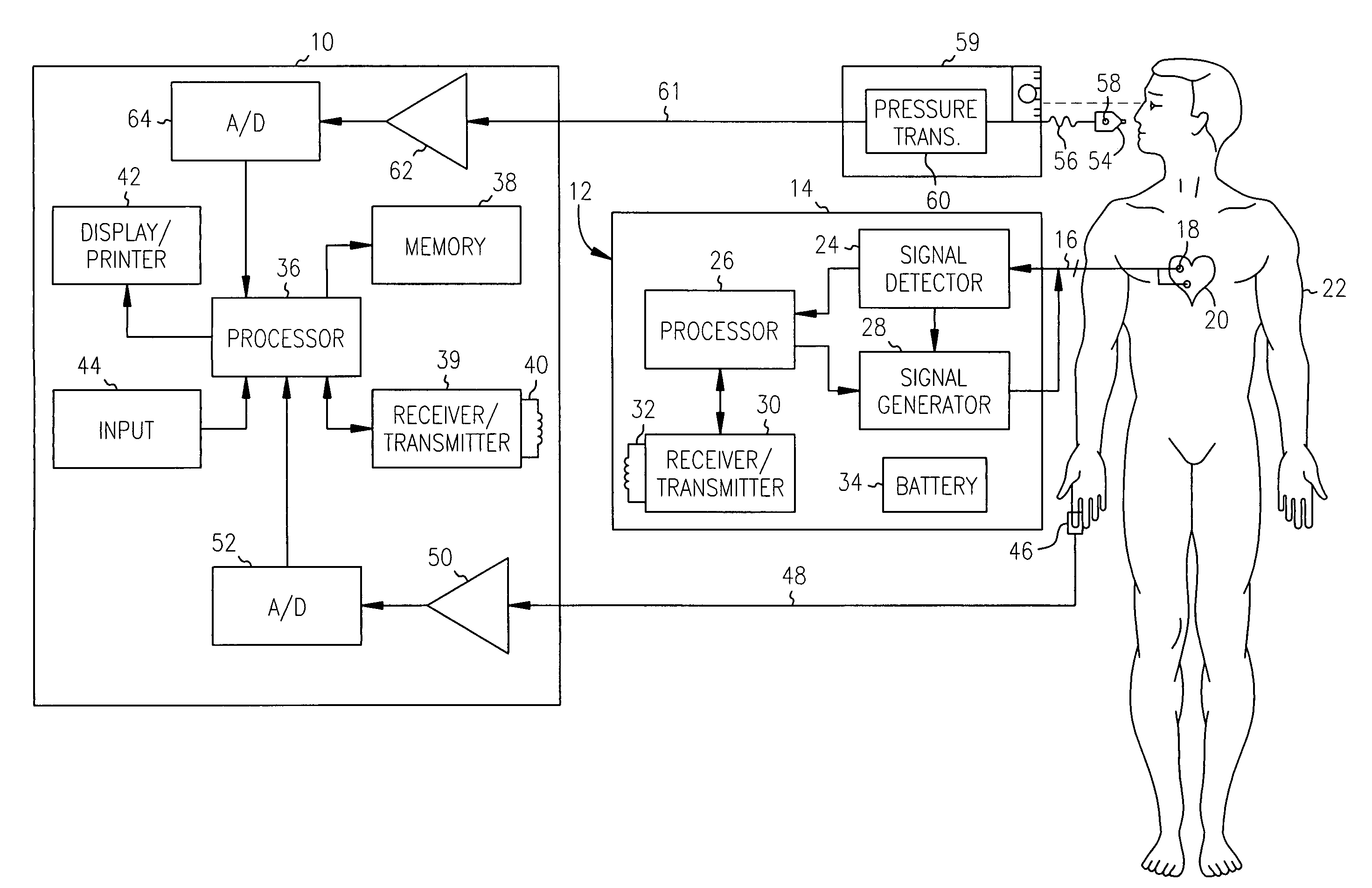 Non-invasive method and apparatus for cardiac pacemaker pacing parameter optimization and monitoring of cardiac dysfunction