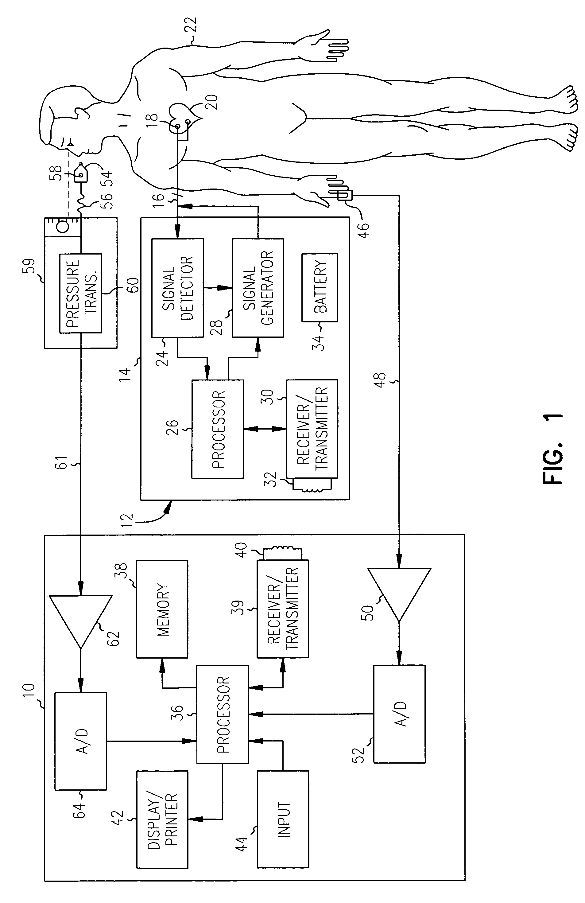 Non-invasive method and apparatus for cardiac pacemaker pacing parameter optimization and monitoring of cardiac dysfunction