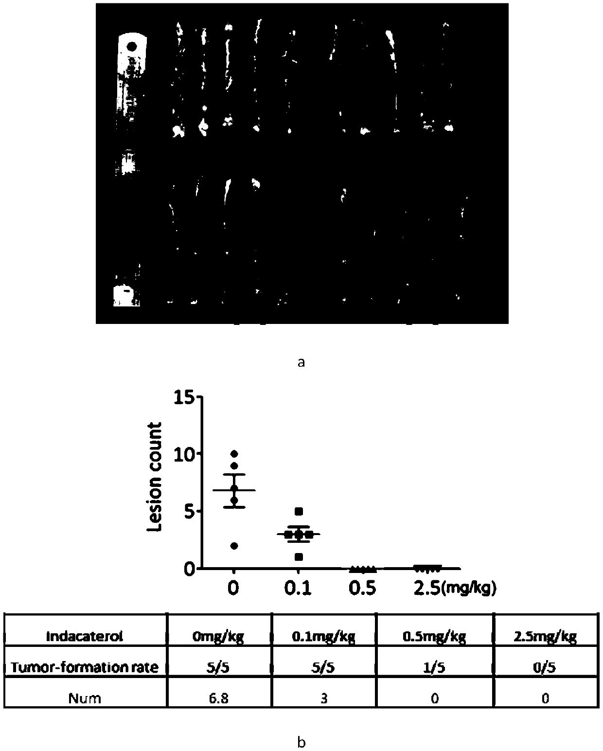 Application of indacaterol in the treatment of colorectal cancer