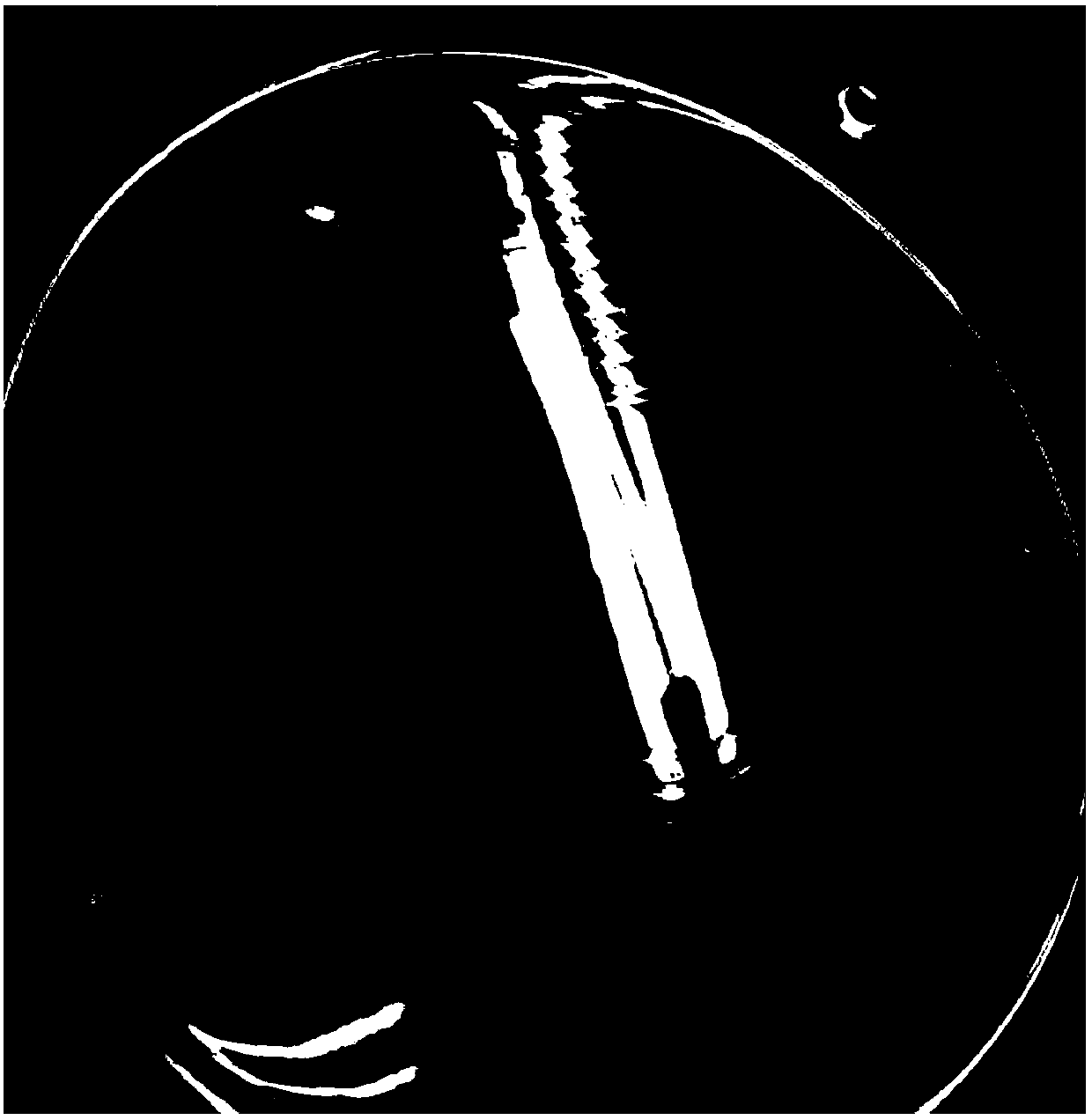 Culture medium for detecting bifidobacterium and detection method