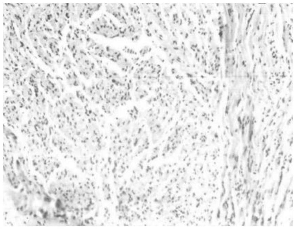 An intelligently regulated absorbable peripheral nerve repair catheter and preparation method thereof