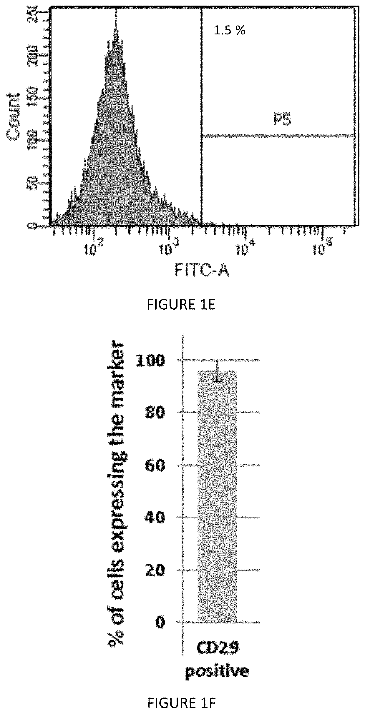 Compositions and methods for treating age-related macular degeneration