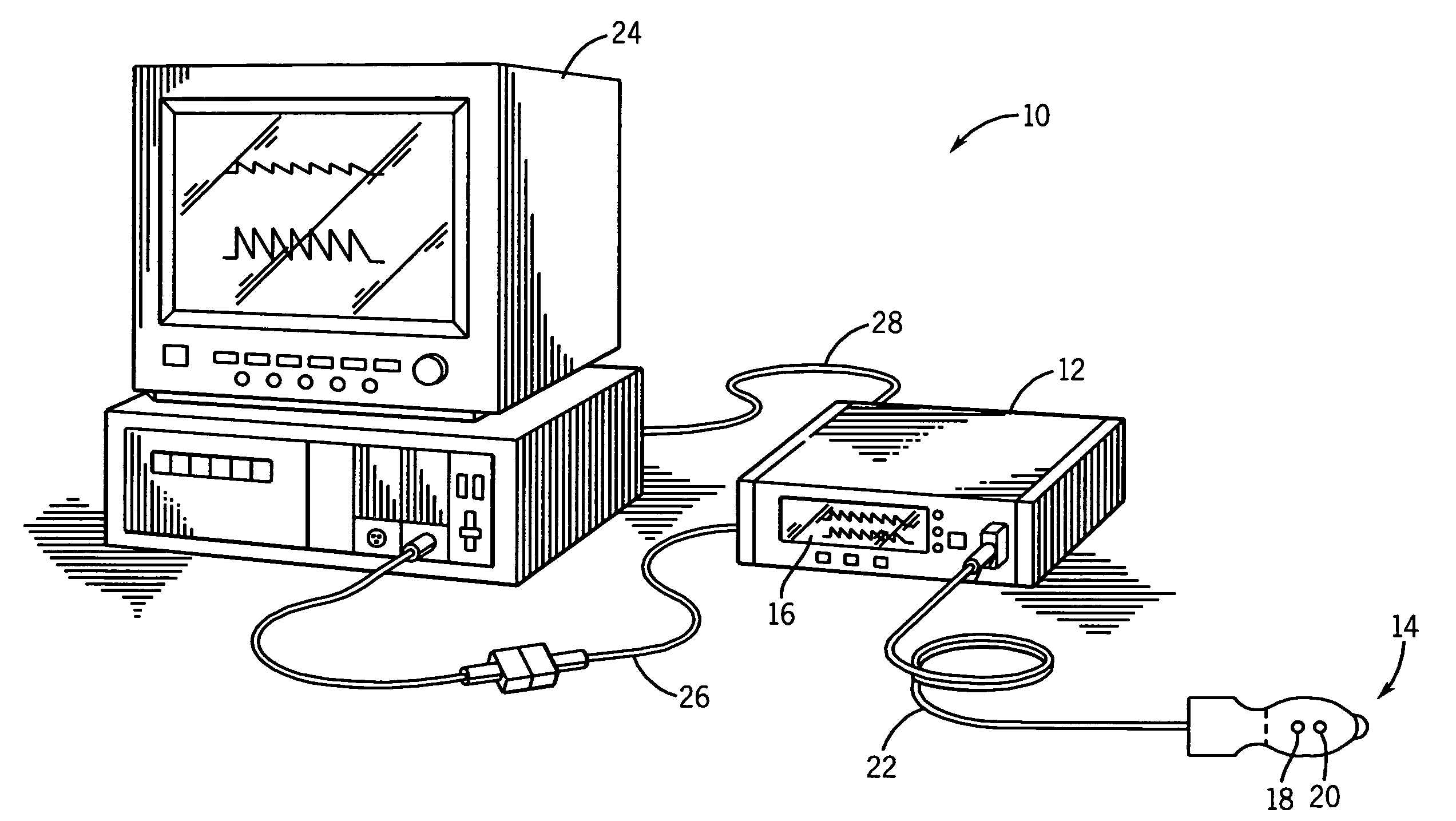 System and method for venous pulsation detection using near infrared wavelengths