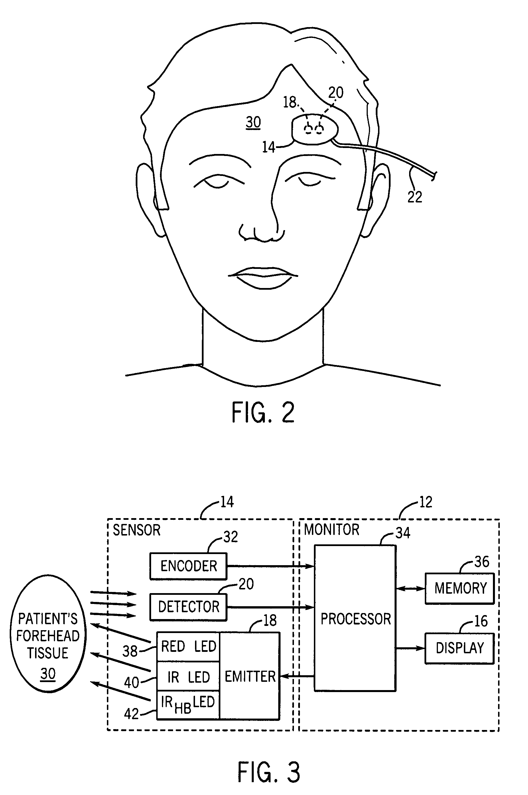 System and method for venous pulsation detection using near infrared wavelengths