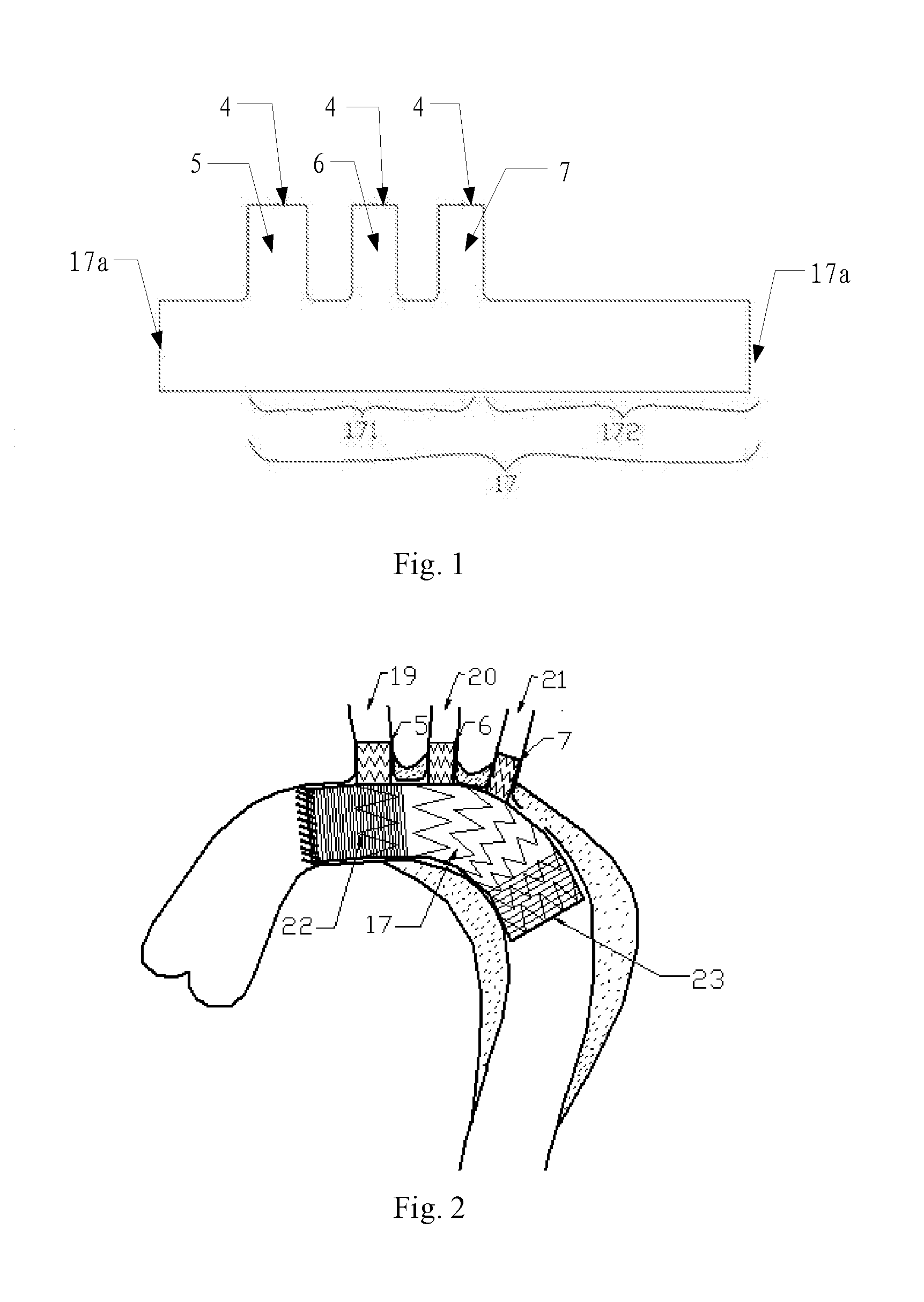 Aortic Arch Intraoperative Stent and Manufacturing Method Thereof