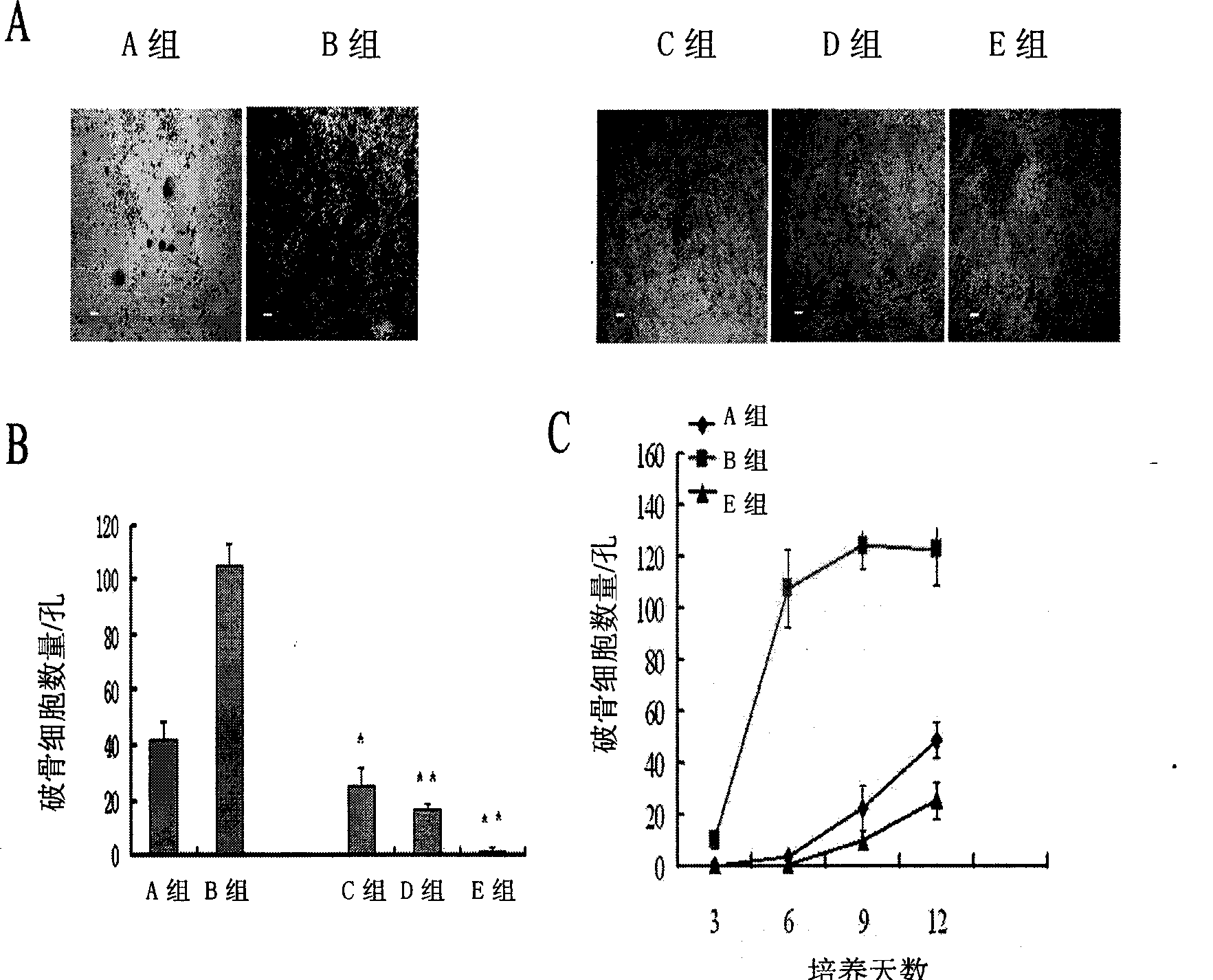 Mesenchyma stem cell for inhibiting osteoclast generation, as well as preparation method and application thereof