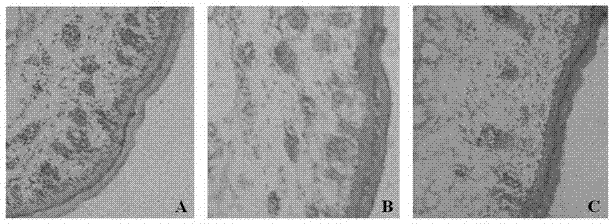 Application of Lin28a gene overexpression AAV (adeno-associated virus) in promotion of wound healing