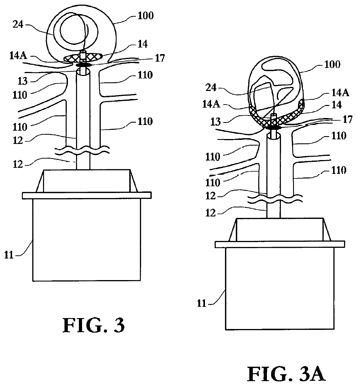 Mesh disc for saccular aneurysms and cover for saccular out-pouching