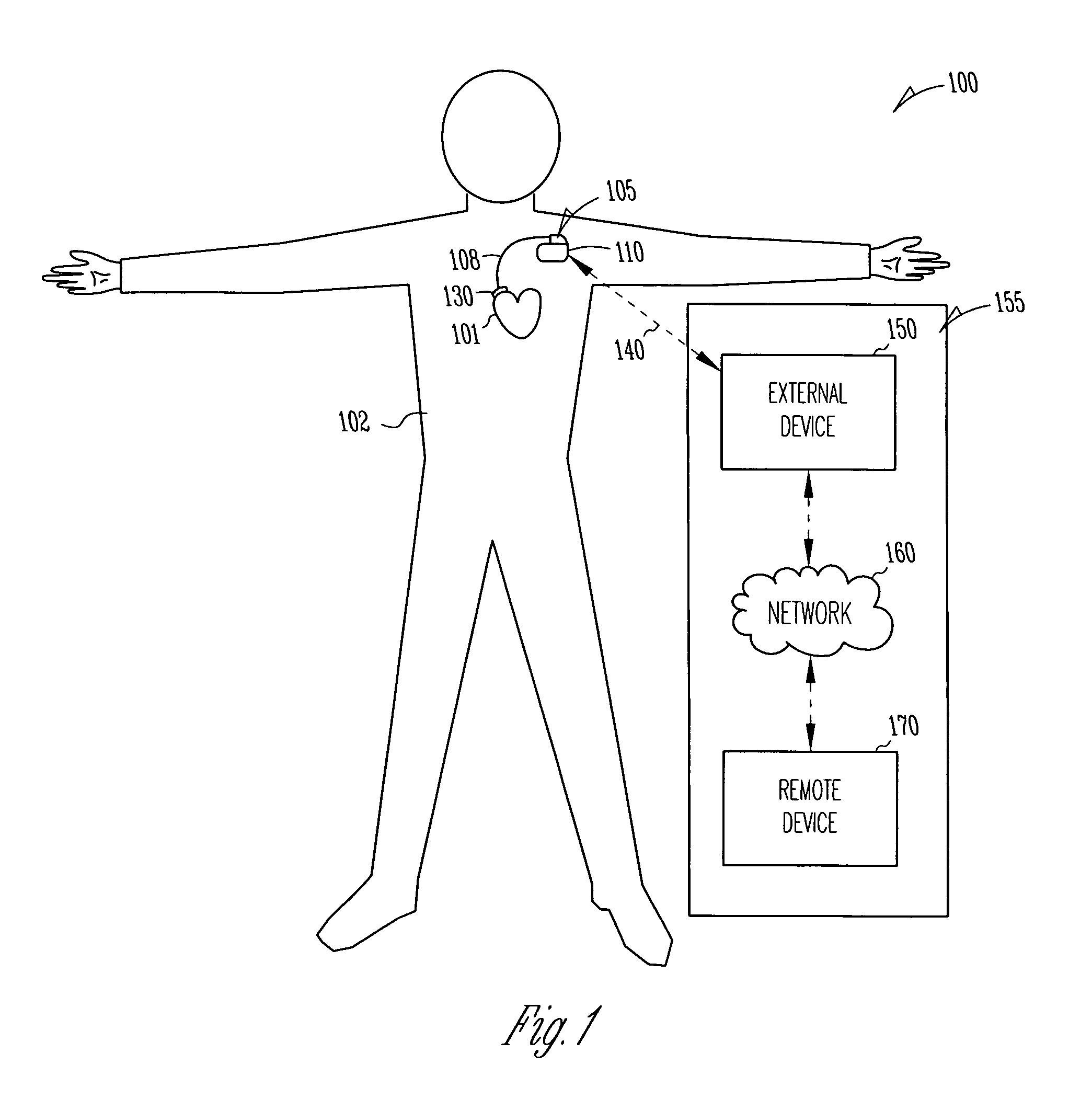 Method and apparatus for device controlled gene expression