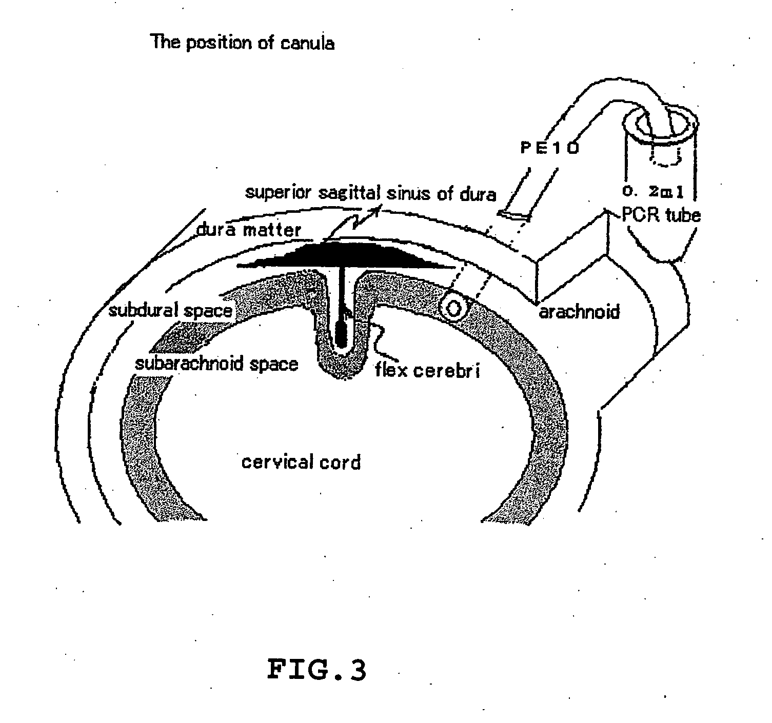 Method of treating or inhibiting the development of brain inflammation and sepsis