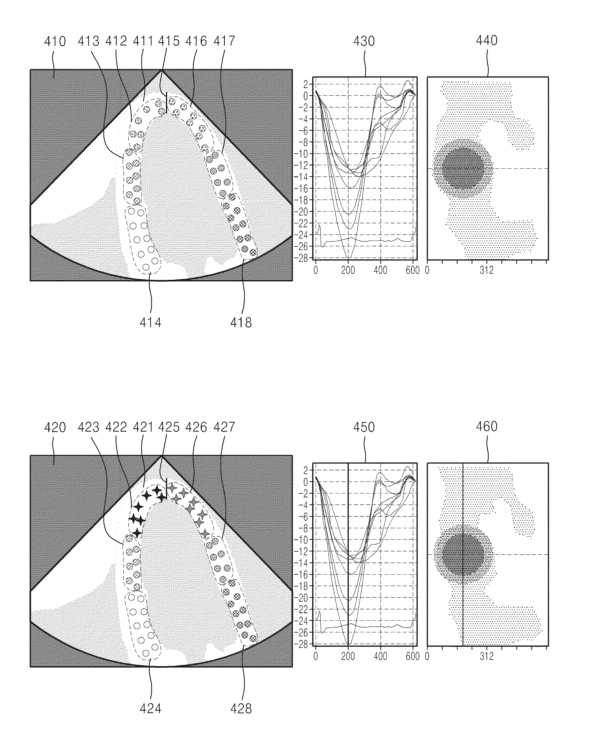 Method and apparatus for medical image display, and user interface screen generating method