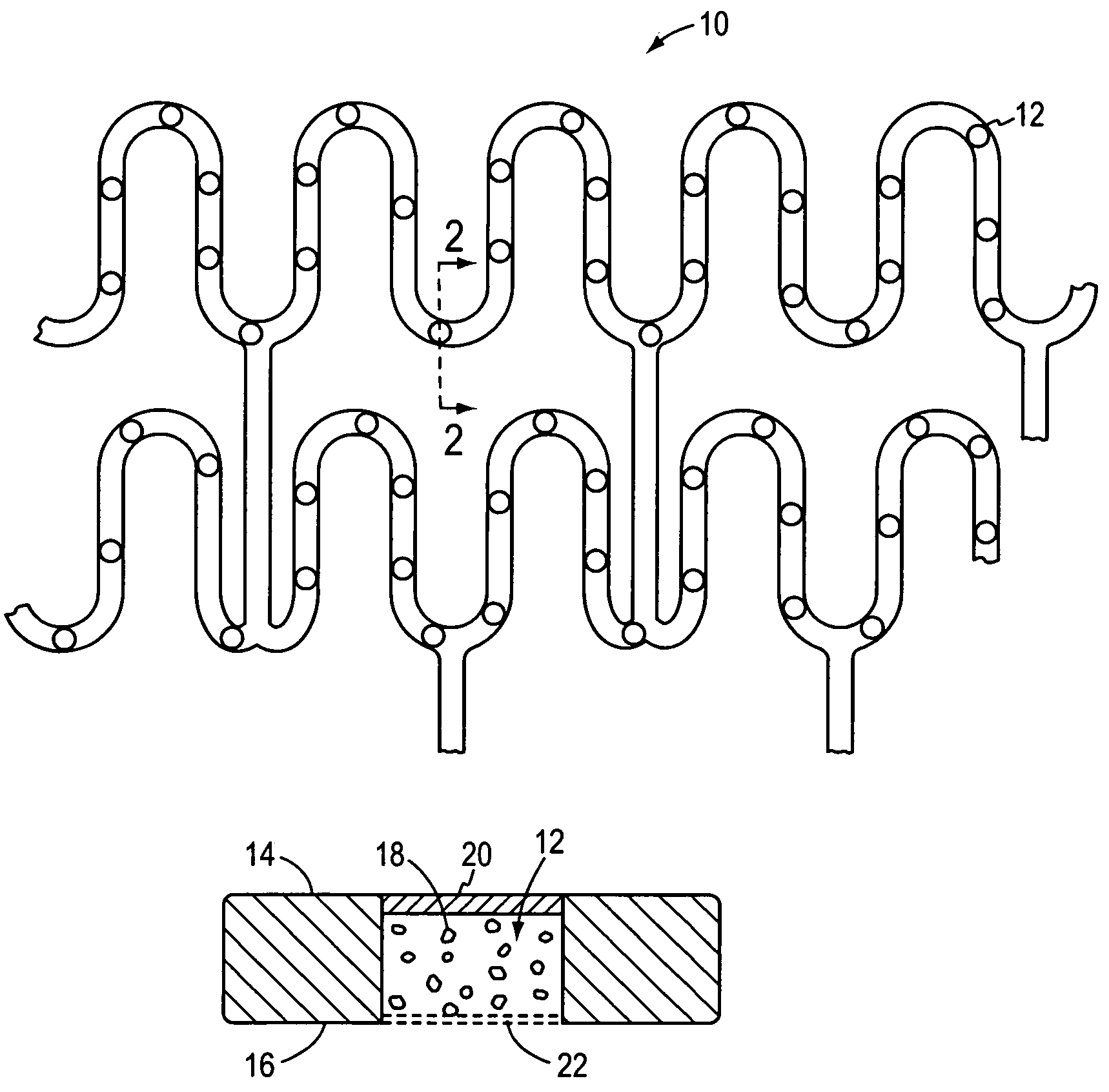 Therapeutic cellular stent