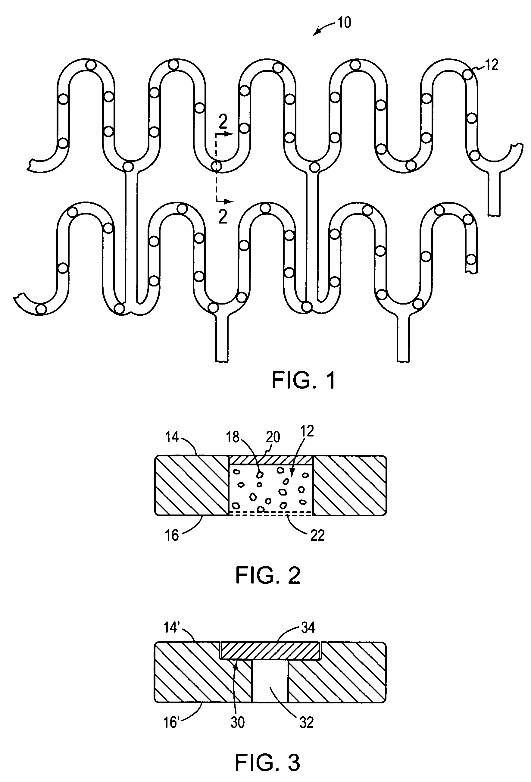 Therapeutic cellular stent