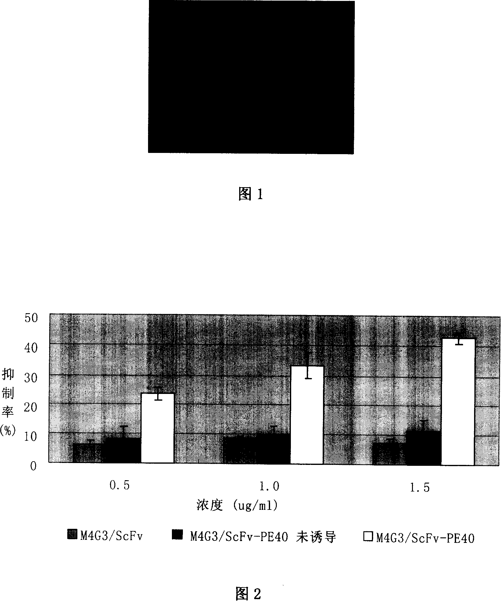 Human breast cancer resisting recombination immunotoxin M4G3/ScFv-PE40