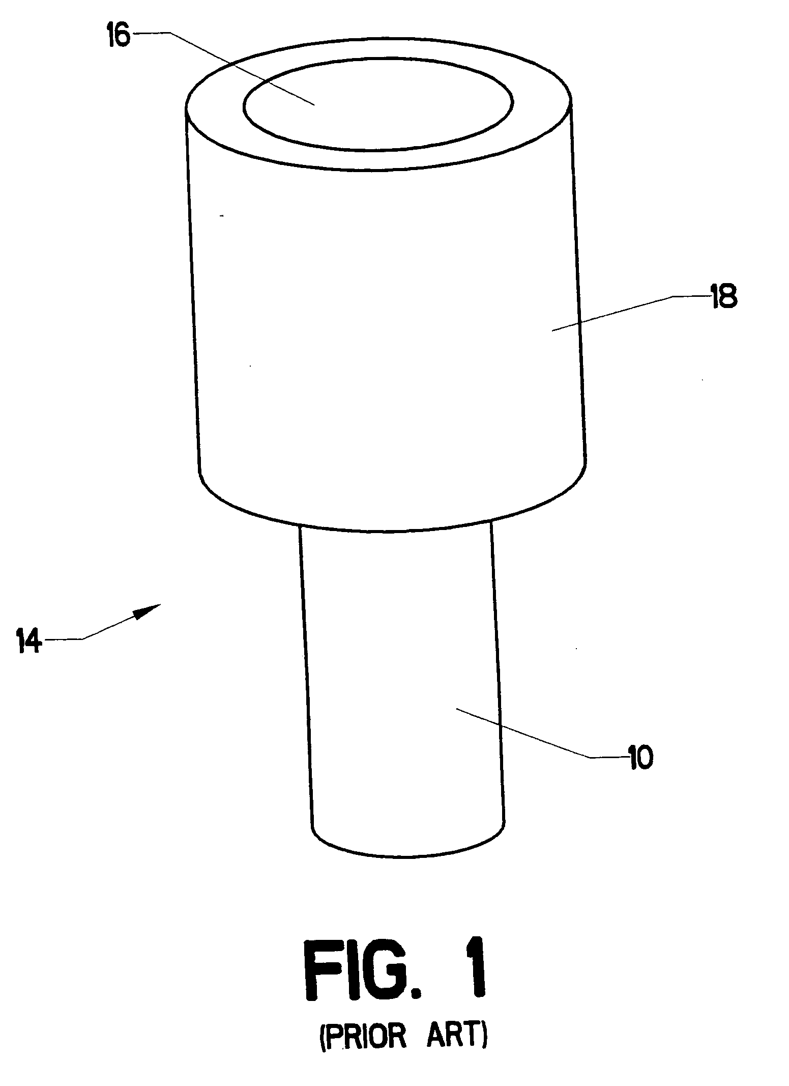 Stress redistributing cable termination