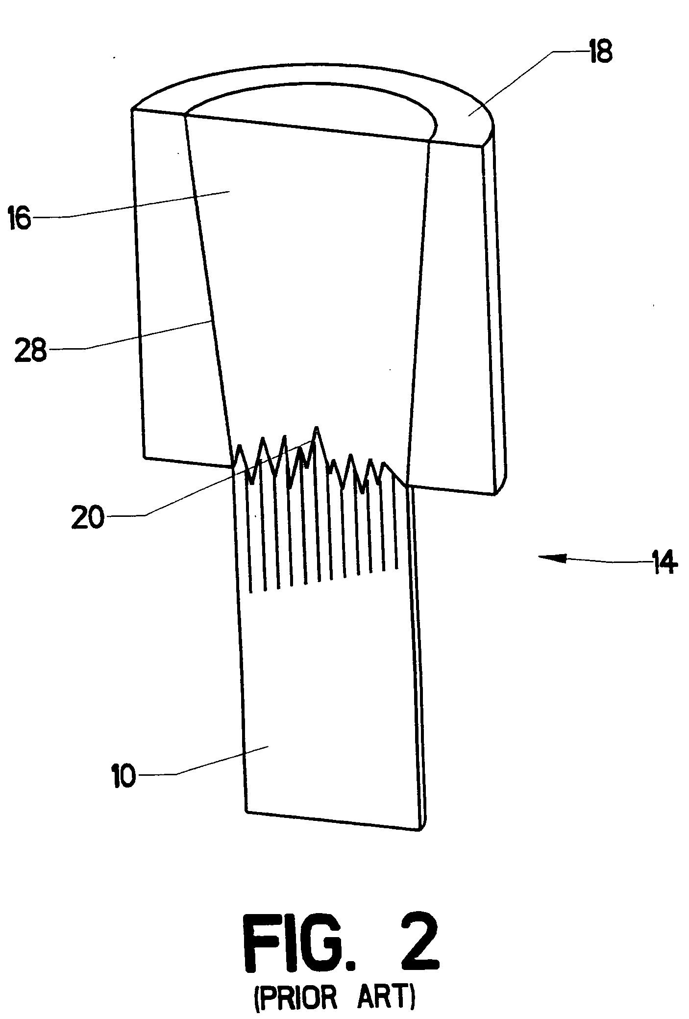 Stress redistributing cable termination