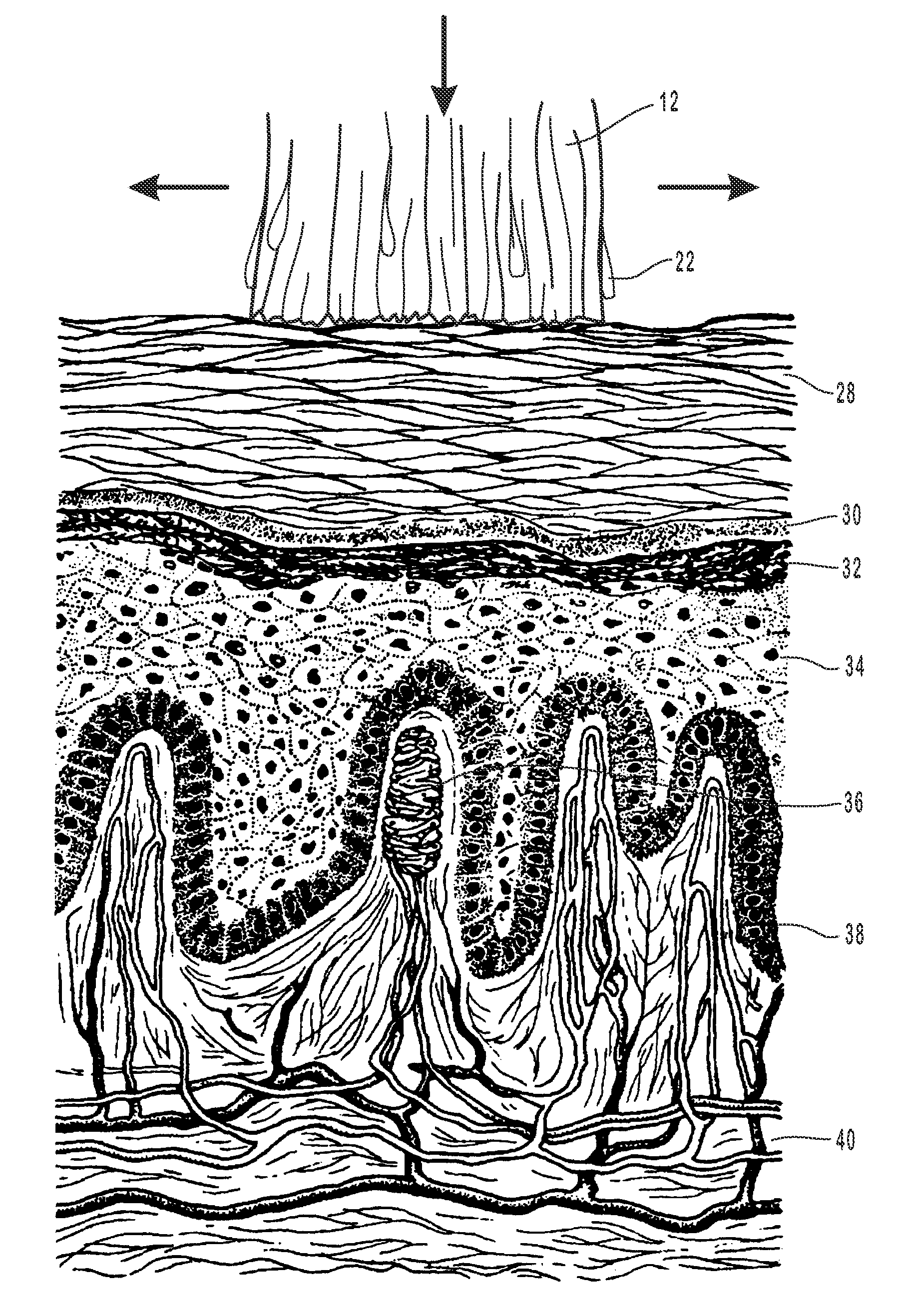 Combined systemic and topical treatment of disordered tissues