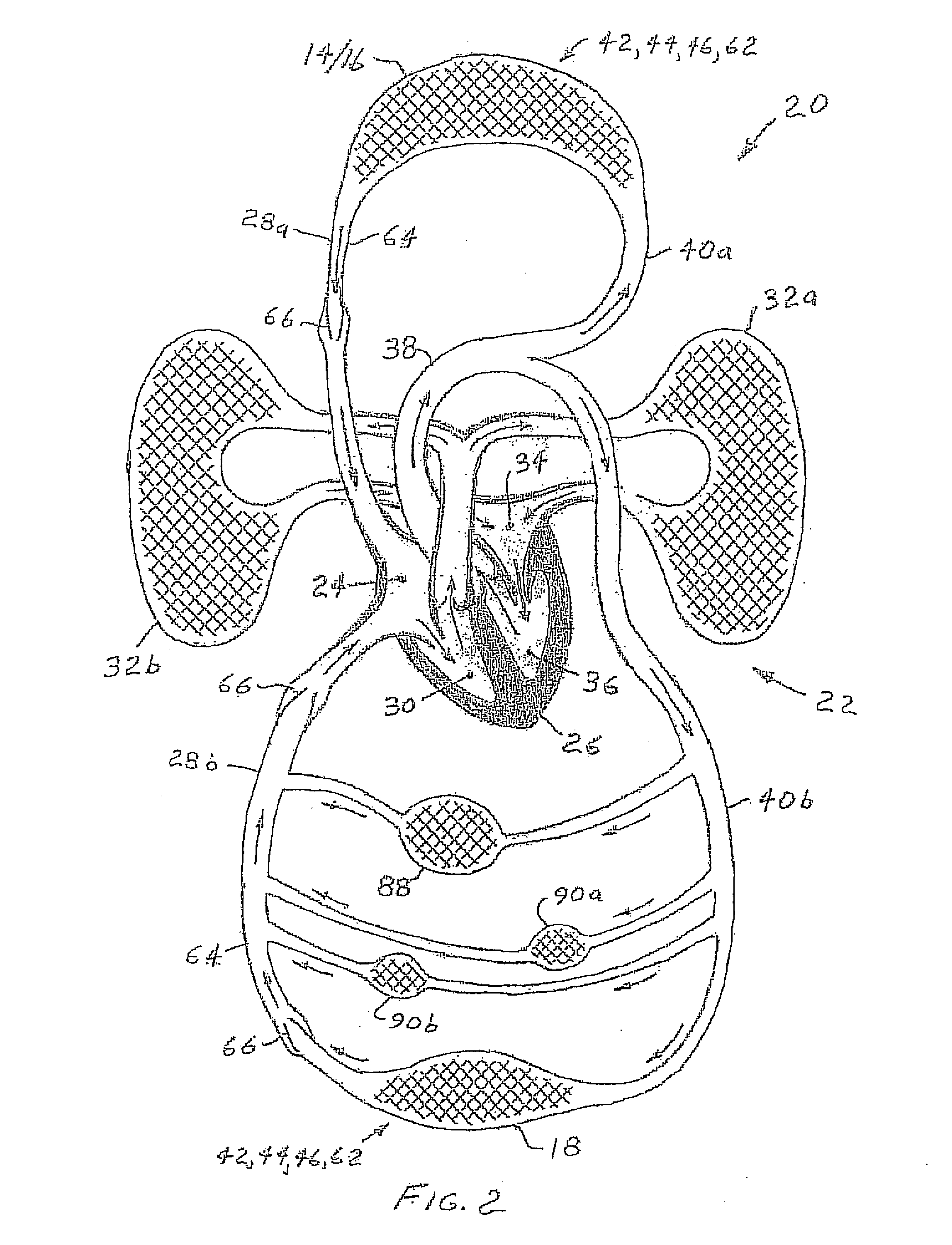 Therapeutic device for inducing blood pressure modulation