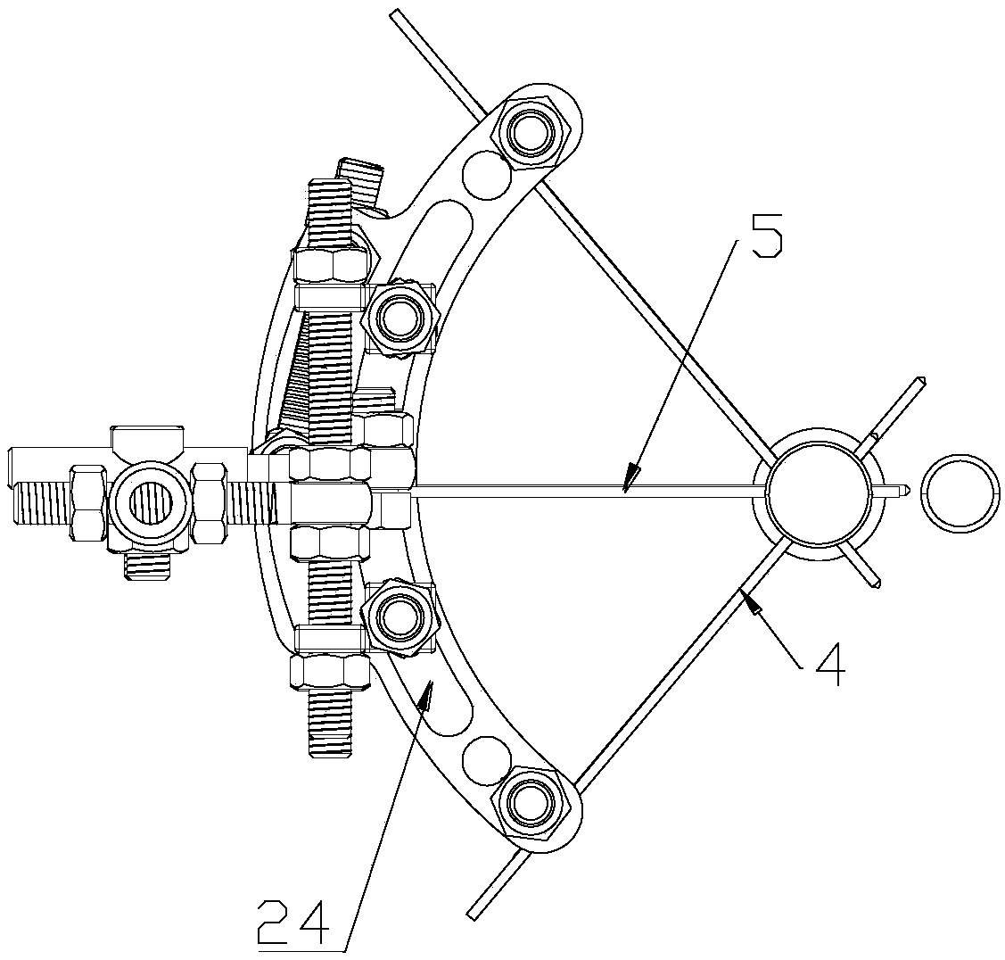 Bone needle fixing device for long bone fracture treatment