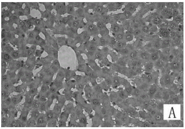 Application of liver protecting Buzure particles to preparation of medicament for treating cholestatic jaundice