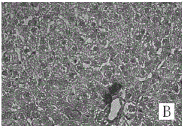 Application of liver protecting Buzure particles to preparation of medicament for treating cholestatic jaundice