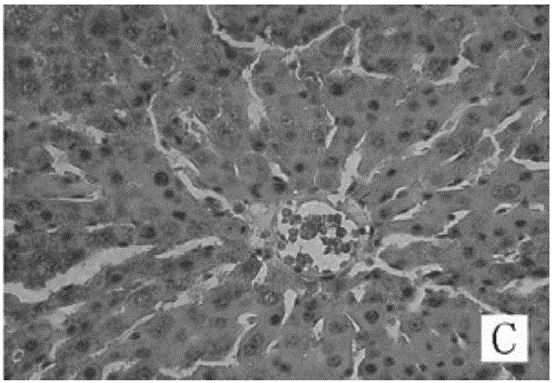 Application of liver protecting Buzure particles to preparation of medicament for treating cholestatic jaundice