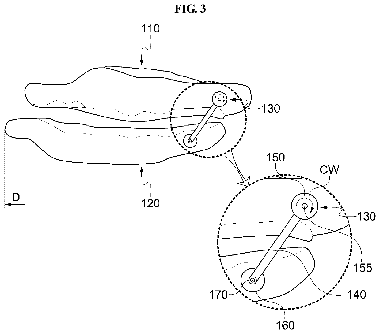 Device for moving lower jaw forward